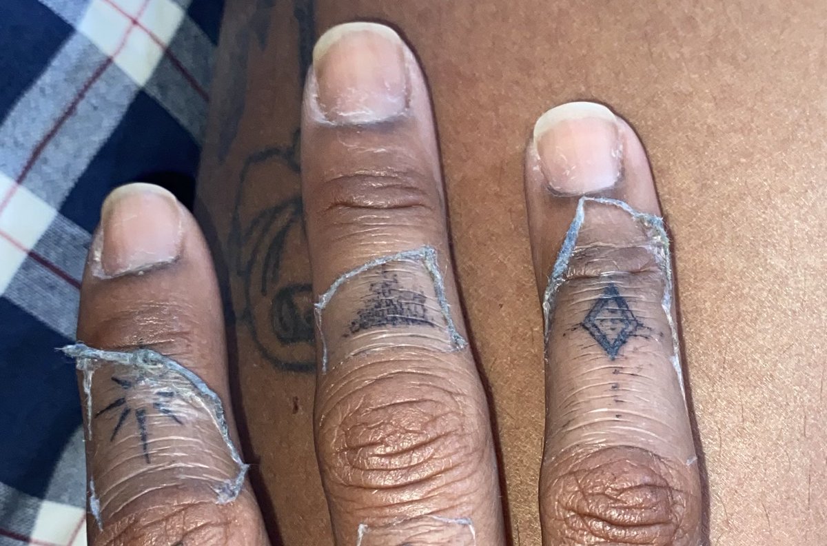 KamiKakason's tweet photo. Normal peoples second skin after 3 days vs my second skin after 3 hours..🥲 https://t.co/xEC5Si45VQ