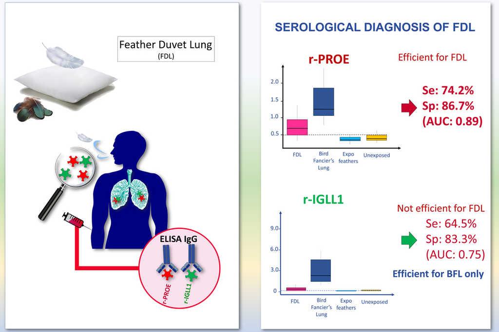 "Pilot Study Using Recombinant Antigens r-PROE and r-IGLL1 for the Serodiagnosis of Feather Duvet Lung", is now available in July's issue of IF6,3 Q1 Arch. Bronconeumología.

🔗 Find it here: archbronconeumol.org/en-pilot-study…

#SEPARrespira #BronconeumologyArchives