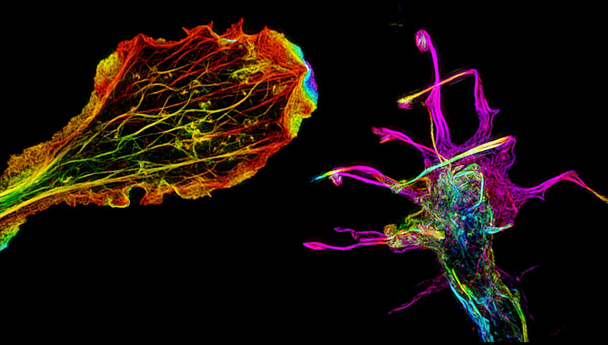 Two neuronal growth cones photographed through a microscope. Actin filaments are shown.
#Science #Biology #CellBiology #Art