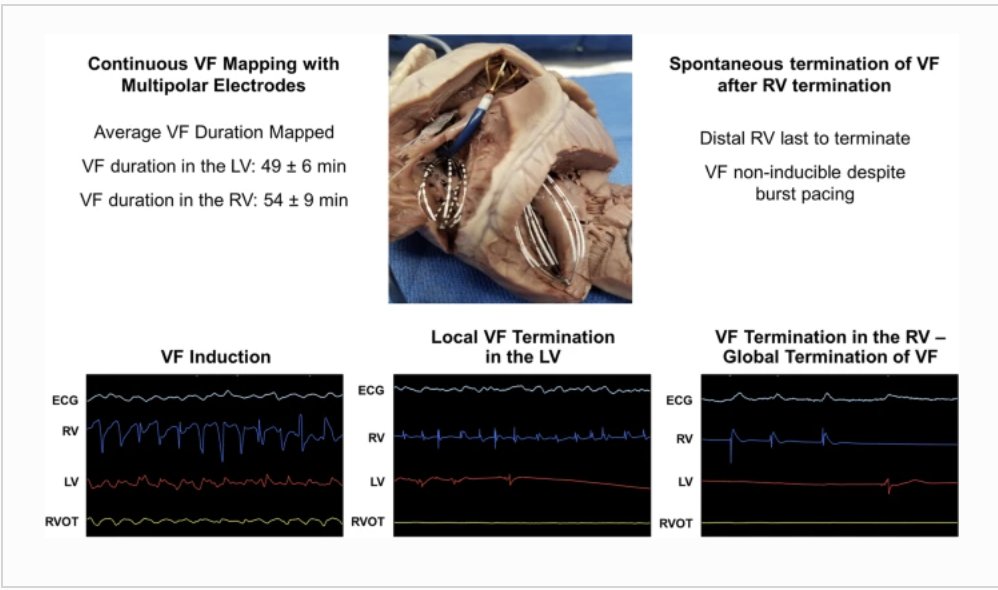 JICE (@jice_ep) on Twitter photo 🚨Hot off the press! <a href="/JICE_EP/">JICE</a>
Novel insights into the substrate involved in maintenance of VF: results from continuous multipolar mapping in a canine model by <a href="/EzzeddineMD/">Fatima Ezzeddine</a>, S Asirvatham & <a href="/DrDeese99/">Christopher DeSimone, MD, PhD</a>
🧐 #FreeRead: rdcu.be/cTrHi
#EPeeps #CardioTwitter <a href="/MayoClinicCV/">Mayo Clinic CV</a> 🚨Hot off the press! <a href="/JICE_EP/">JICE</a>
Novel insights into the substrate involved in maintenance of VF: results from continuous multipolar mapping in a canine model by <a href="/EzzeddineMD/">Fatima Ezzeddine</a>, S Asirvatham & <a href="/DrDeese99/">Christopher DeSimone, MD, PhD</a>
🧐 #FreeRead: rdcu.be/cTrHi
#EPeeps #CardioTwitter <a href="/MayoClinicCV/">Mayo Clinic CV</a>
