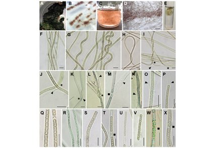 Phytotaxa's tweet photo. Siamcapillus rubidus gen. et sp. nov. (#Oculatellaceae), a novel filamentous cyanobacterium from #Thailand based on molecular and morphological analyses
#Taxonomy
https://t.co/mhKH139cXX https://t.co/GH2aRUmkEM