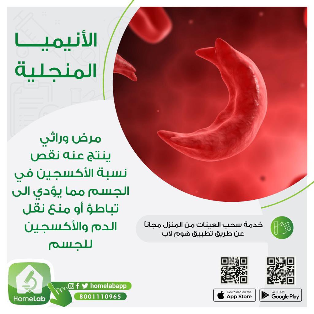 اش تعرف عن الأنيميا المنجلية ؟
مرض وراثي ينتج عنه نقص نسبة الأكسجين افحص وتطمن على نفسك👍🏻💪

مع #هوم_لاب نخدمك وأنت بمكانك 💉 

حمل التطبيق آلان 📲
 
onelink.to/u4jwau