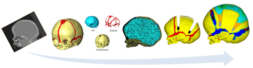 mehran_moazen's tweet photo. We are looking for self-motivated #PhDstudents to come and join us @moazenlab @uclmecheng @ucl to work on the #mechanics of #craniofacial #system. Please share &amp; contact me if you are interested #phdstudentship #biomechanics #insilico #craniosynostosis see https://t.co/m6bSEqvclW https://t.co/jrUImeJj9o