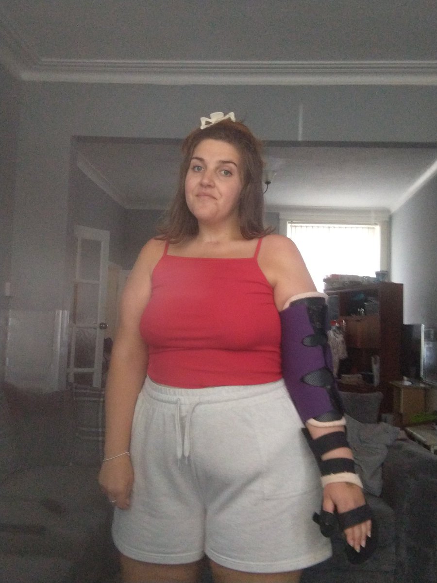 Itsjessc00k's tweet photo. My summer look yesterday π€£
I was trying to look sad but laughed π
#icu #CovidSurvivor #covid #recovery #spinalstroke #stroke #spinalinjury #spinalcordinjuryawareness #limbweakness #limbdifference #splints #physio #OT #disbalityawareness #disability
#upperlimbweakness https://t.co/OPe24byShJ
