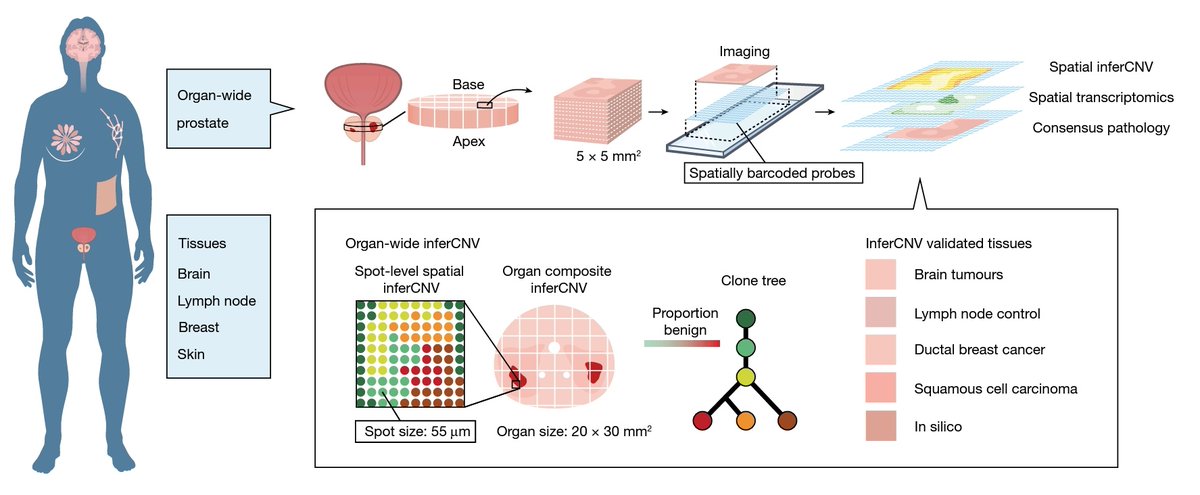 Delighted to share our new paper in @Nature on “Spatially resolved clonal copy number alterations in benign and malignant tissue”. Collaborative effort from @NDSurgicalSci @UniOfOxford & @SciLifeLab @KTHUniversity & many others. #Organscale nature.com/articles/s4158… 1/15