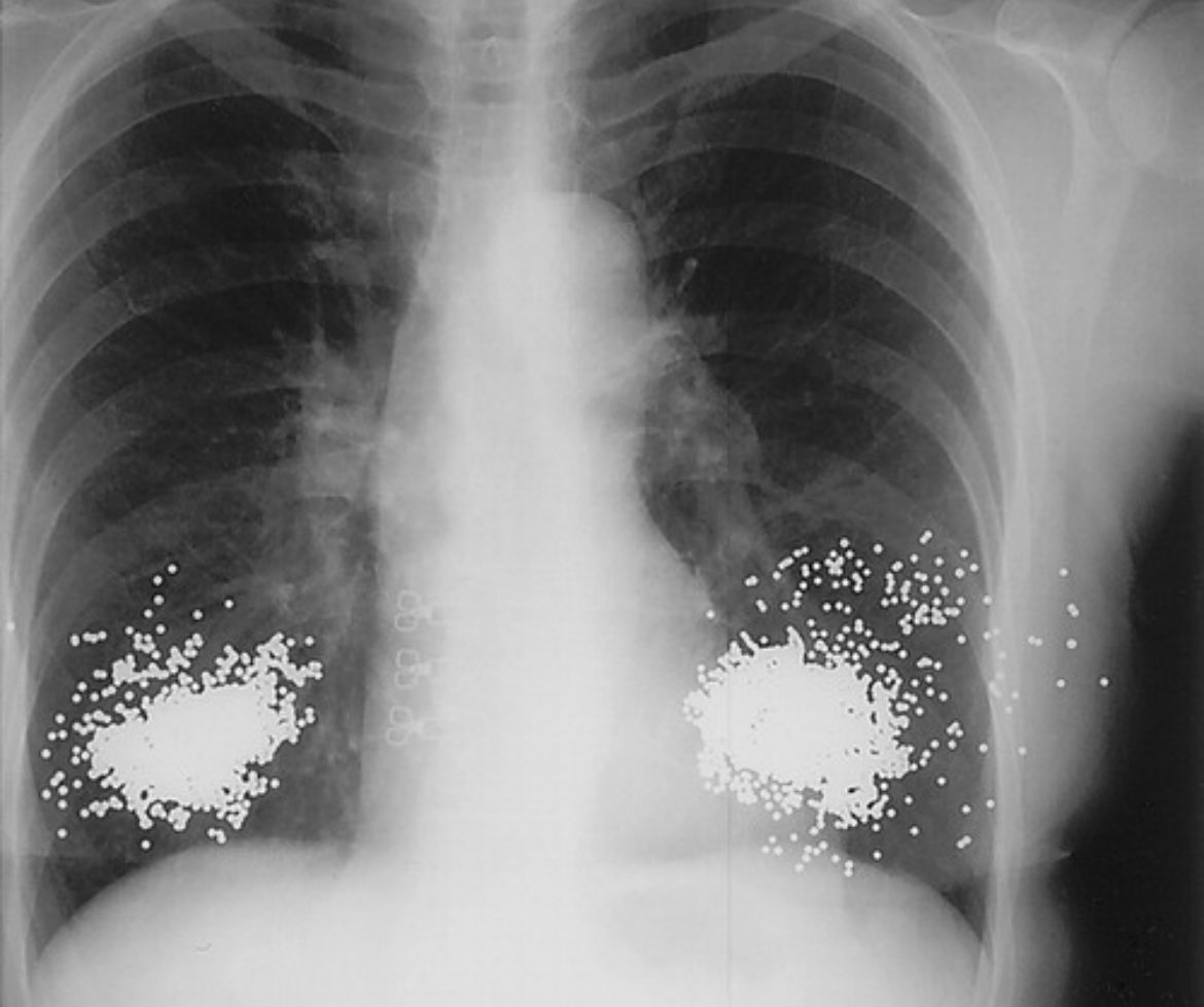 acr career center radiology jobs