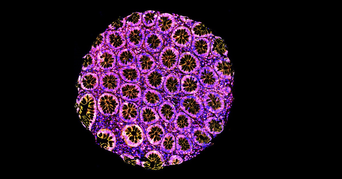 Research@Queen's University (@queensuresearch) on Twitter photo #Queensu Harriet Feilotter received funding from <a href="/OICR_news/">Ontario Institute for Cancer Research (OICR)</a> to help hospitals in finding the best way to test tumours for #cancer biomarkers. A centralized lab will improve how Ontario makes genetic research available to cancer patients. Learn more: bit.ly/3JQG3an #Queensu Harriet Feilotter received funding from <a href="/OICR_news/">Ontario Institute for Cancer Research (OICR)</a> to help hospitals in finding the best way to test tumours for #cancer biomarkers. A centralized lab will improve how Ontario makes genetic research available to cancer patients. Learn more: bit.ly/3JQG3an