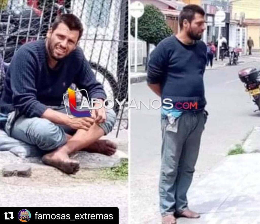 #Repost famosas_extremas with <a href="/use/">Roslyn K.</a>.repost
・・・
🚨La triste historia de un extranjero en Colombia.😥 El hombre fue víctima de una fuerte droga para poder robarlo, dejándolo en un estado de inconsciencia que todavía padece. 😕

“Hace 4 años este hombre… instagr.am/p/ChHhjsFAD1K/