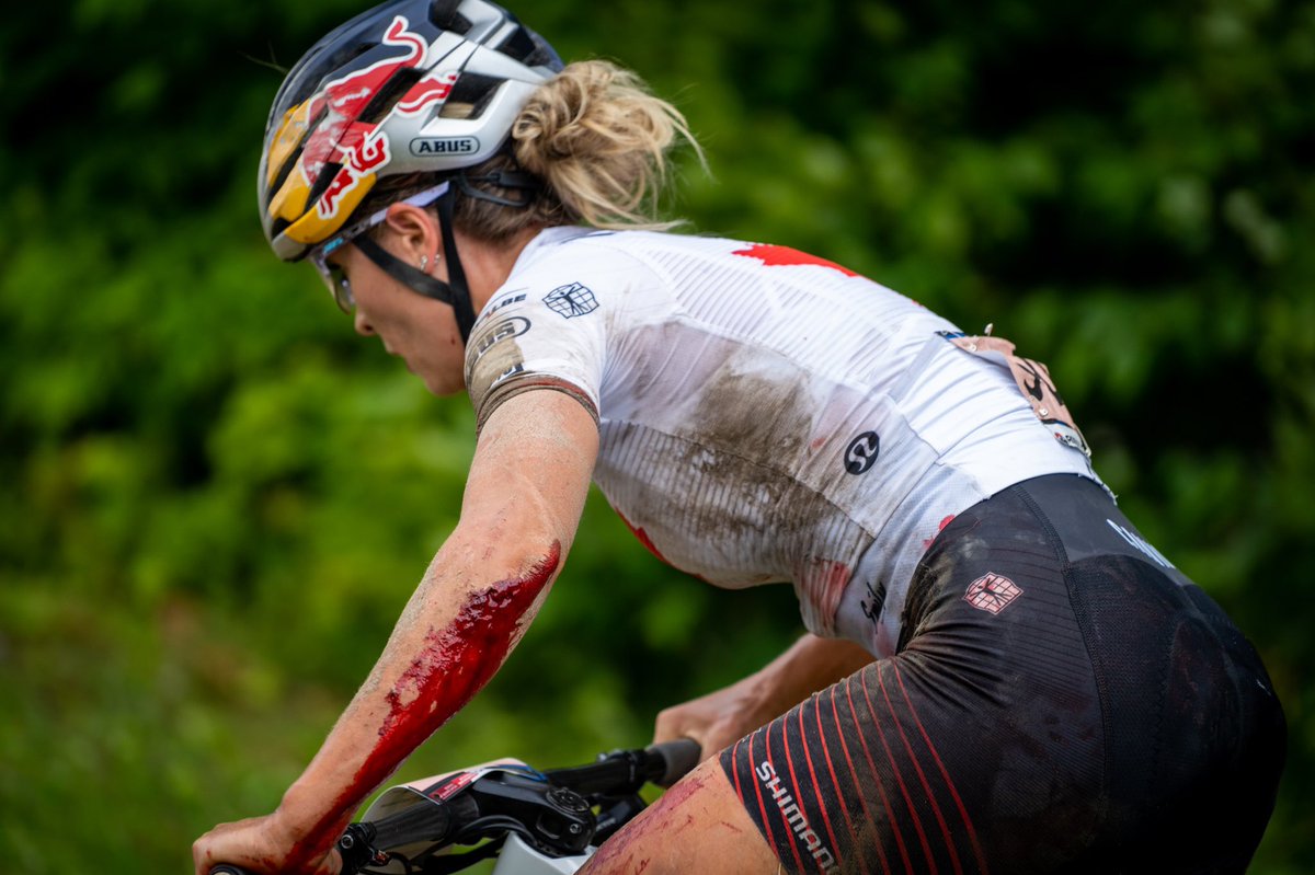 emilybatty's tweet photo. @bassmanof40 @HarveysCanada @RedBullCanada 4 stitches. It’s healing now. https://t.co/5n8CxTy3PS
