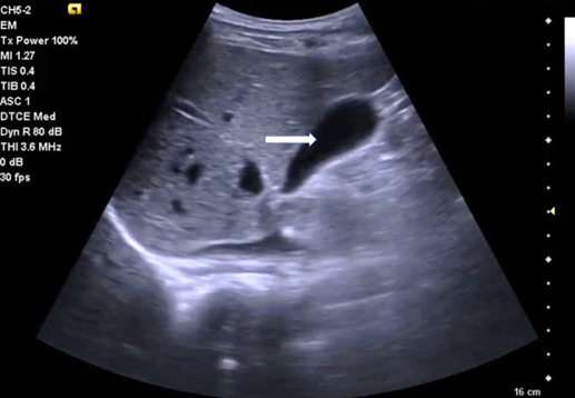 POCUS Certification Academy tweet media