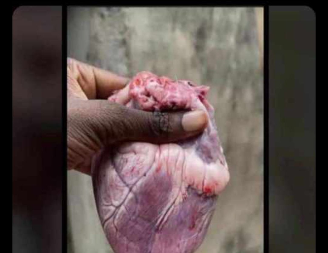 He cheated on me and I decided to remove his heart😐,na person wey get heart dey get feelings 🚶🚶