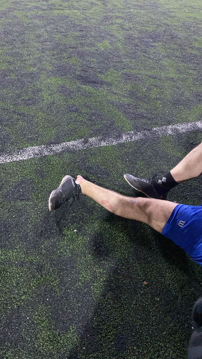 Confío en la magia del tw! 🎩

A este amigo que jugando al fútbol lesionó el tobillo queremos llegar.. KINETICS se hace cargo 100% de su recuperación..  ⚽️🥇
  
Yo se que lo va necesitar!✨️
 
Rt hasta llegar a este jugador hasta contactarlo! 📲