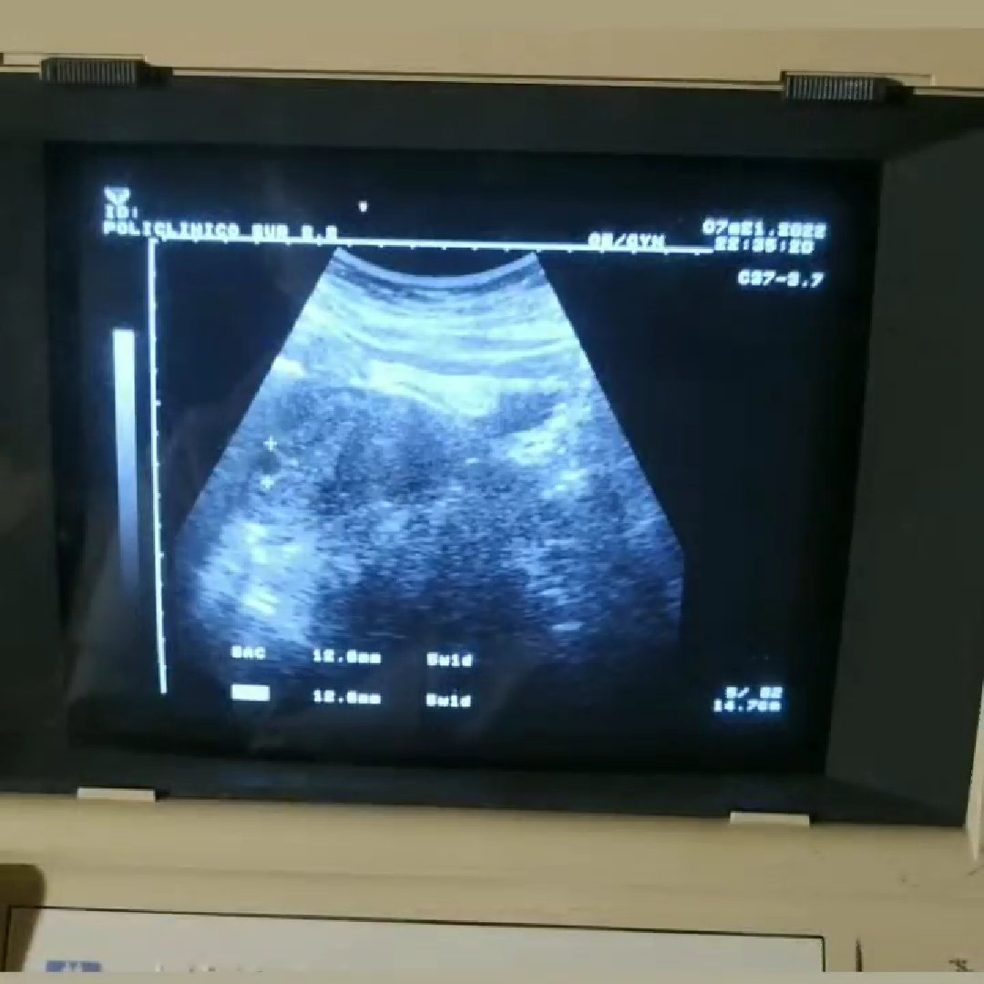 ClaoRguez's tweet photo. Dentro de mi llevo luz, vida y amor. 💙🤰🏼 Hace varias semanas atrás me confirmaron esta bendición. 😍 
#FuturaMadre https://t.co/yeWU4QPtjz