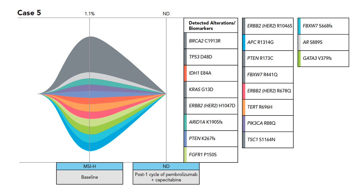 Arndt Vogel (@arndtvogel) on Twitter photo 🤔How to treat MSI-high gastric cancer patients before surgery❓
👉interesting cases with IO-based neoadjuvant treatment with serial ctDNA sequencing in <a href="/JNCCN/">Journal of the @NCCN</a>
doi.org/10.6004/jnccn.…
✅high ORR inline with NEONIPIGA & DANTE
👉early testing❗️
<a href="/myESMO/">ESMO - Eur. Oncology</a> #Immunotherapy 🤔How to treat MSI-high gastric cancer patients before surgery❓
👉interesting cases with IO-based neoadjuvant treatment with serial ctDNA sequencing in <a href="/JNCCN/">Journal of the @NCCN</a>
doi.org/10.6004/jnccn.…
✅high ORR inline with NEONIPIGA & DANTE
👉early testing❗️
<a href="/myESMO/">ESMO - Eur. Oncology</a> #Immunotherapy