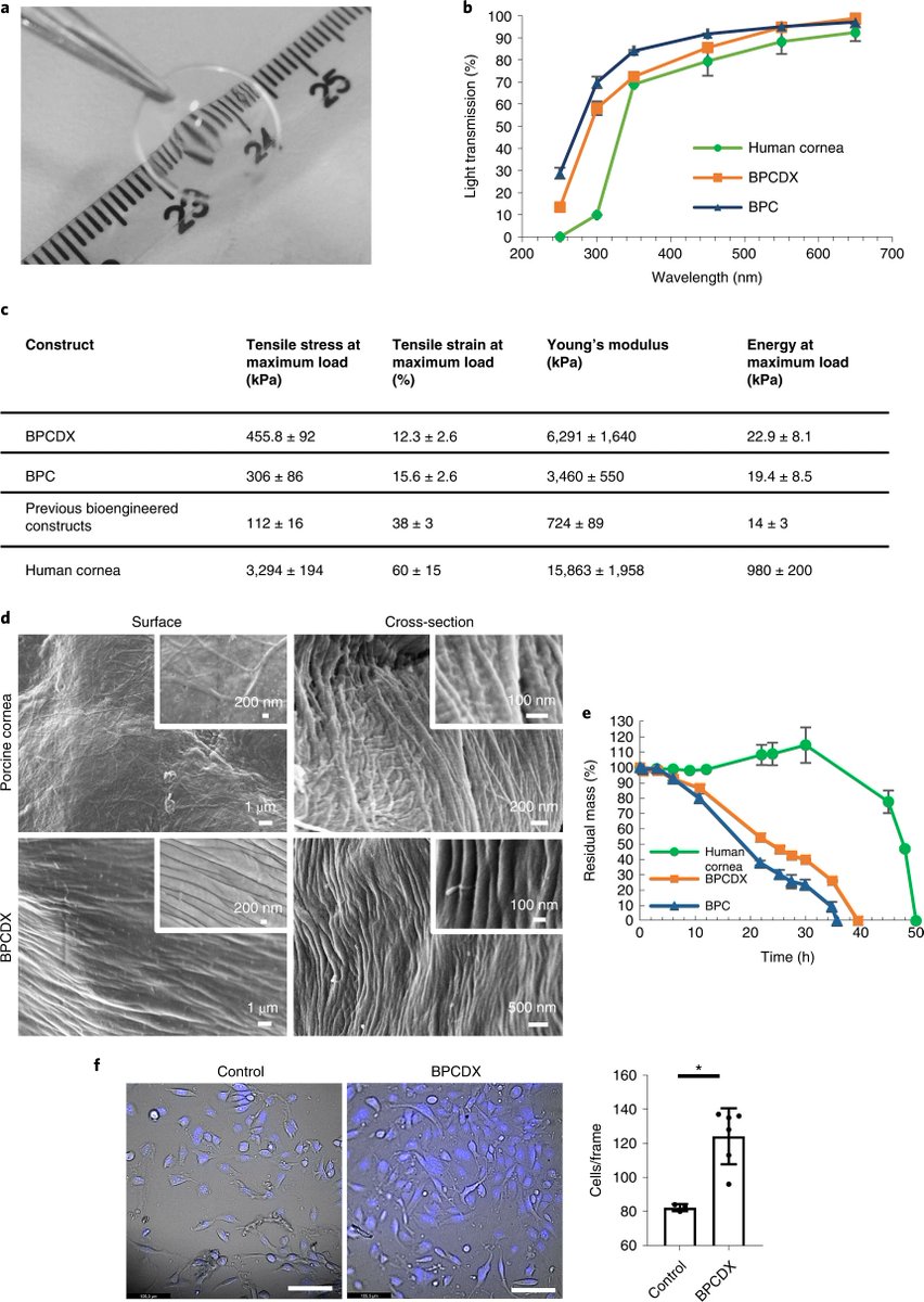 NatureBiotech's tweet image. Bioengineered corneal tissue for minimally invasive vision restoration in advanced keratoconus in two clinical cohorts go.nature.com/3zRcMYt