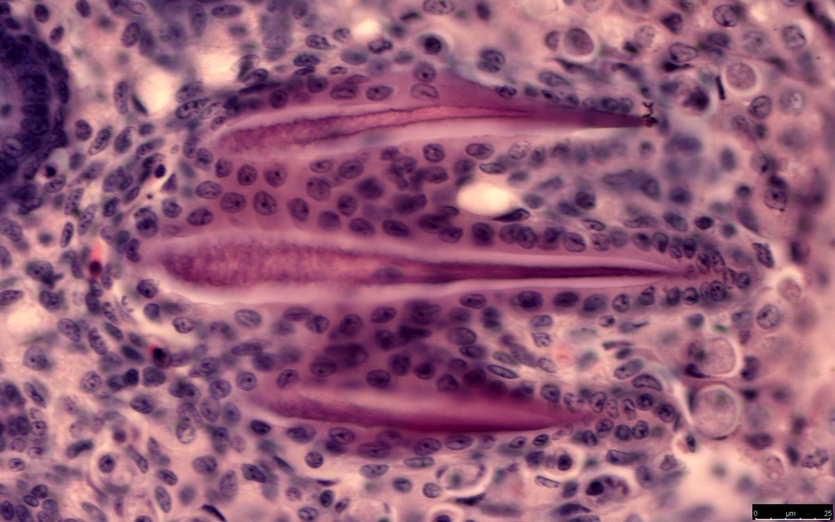 Gareth Fraser (@garethjfraser) on Twitter photo Check out this histological section of an emerging skin-tooth (dermal denticle) on the tail of an embryonic Bonnethead #shark (Sphyrna tiburo). The cusps are still embedded in the skin and surrounded by dental cells. H&E stained. Section by Steven Byrum. <a href="/UFBiology/">UF Department of Biology</a> <a href="/UF_CLAS/">UF College of Liberal Arts and Sciences</a> 🦷🦈 Check out this histological section of an emerging skin-tooth (dermal denticle) on the tail of an embryonic Bonnethead #shark (Sphyrna tiburo). The cusps are still embedded in the skin and surrounded by dental cells. H&E stained. Section by Steven Byrum. <a href="/UFBiology/">UF Department of Biology</a> <a href="/UF_CLAS/">UF College of Liberal Arts and Sciences</a> 🦷🦈