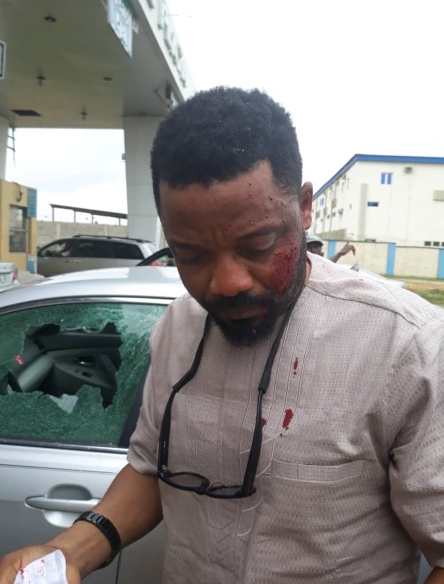 Tunde_Adeparusi's tweet photo. @Princemoye1 Cc @DavidHundeyin @PoliceNG 
On the 20th of July 2018, 4 officers of the Nigeria Police Force fired shots indiscriminately around the airport tollgate while chasing a vehicle. I narrowly escaped death as my vehicle was riddled with bullets, some of which came (1) https://t.co/iDi30SyTtw