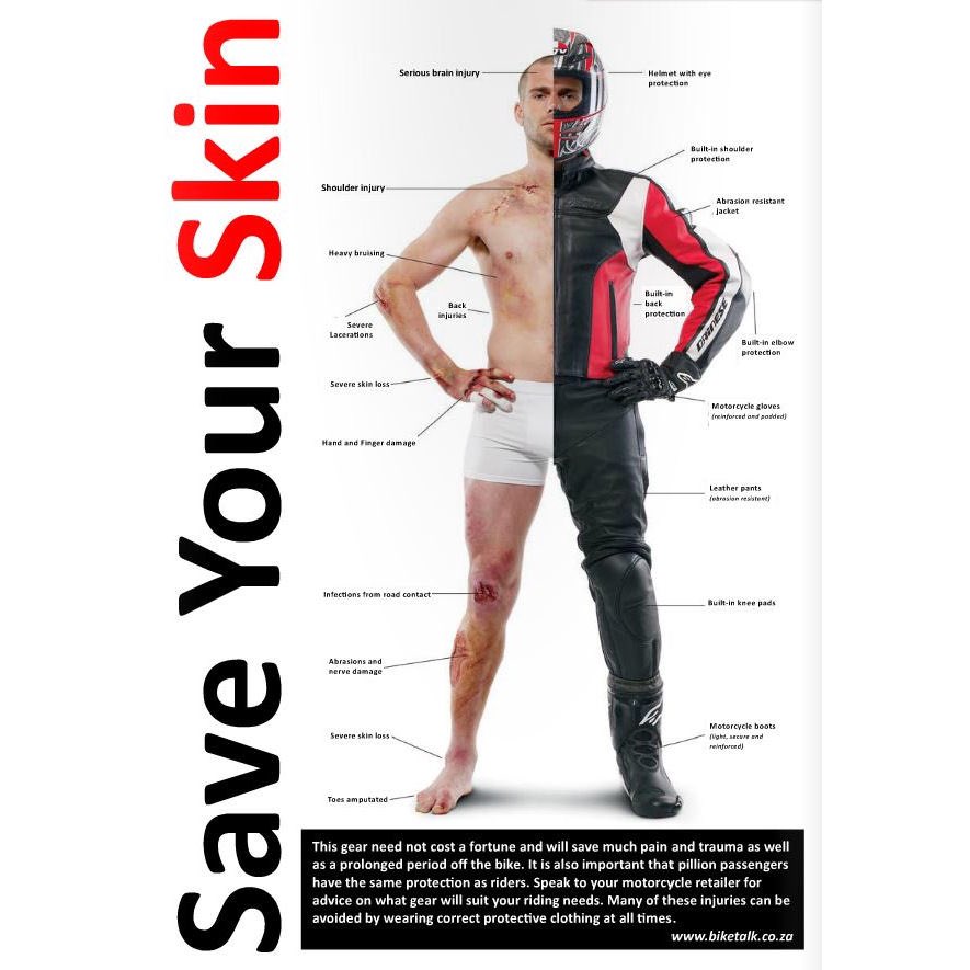 OFFICIALWMAS's tweet photo. We're seeing lots of bikers swapping leathers for shorts and T-shirts in the hot weather 😳 

Is it worth the risk? Remember #LeathersSavesSkin https://t.co/Q6y9sIPjZQ