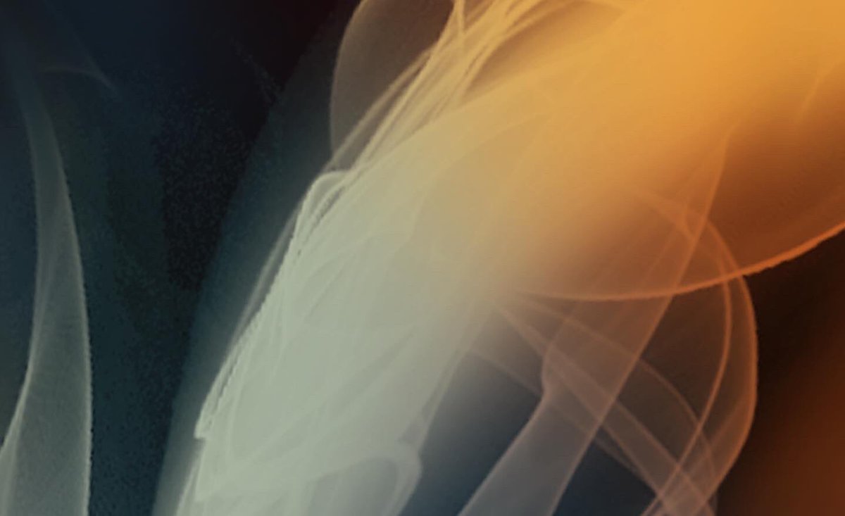 IsolationTX's tweet image. Soon.