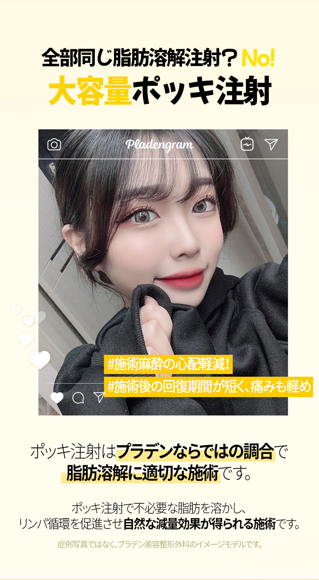 公式 プラデン美容外科 プラデンといえばポッキ注射 ポッキ注射は顔から足まで全身の施術が可能です ダイエットがなかなか続かない方 二の腕やポッコリお腹 太もも 二重あごなどの部分痩せご希望の方 是非一度プラデンのポッキ注射をお