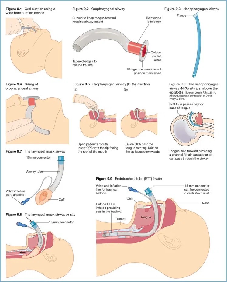 #KylieMcK (@kylie_mck) on Twitter photo 📢Are you Managing a Patients airway? Ensure:
✔️All loose packaging goes straight into a waste bin
✔️All airway circuits are closed off when not in use&checked before use📢These are just 2❓'s being audited from a #NPSA to #reduceriskofforeignbodyaspiration <a href="/UHMBT/">MorecambeBayNHSTrust</a> #patientsafety 📢Are you Managing a Patients airway? Ensure:
✔️All loose packaging goes straight into a waste bin
✔️All airway circuits are closed off when not in use&checked before use📢These are just 2❓'s being audited from a #NPSA to #reduceriskofforeignbodyaspiration <a href="/UHMBT/">MorecambeBayNHSTrust</a> #patientsafety