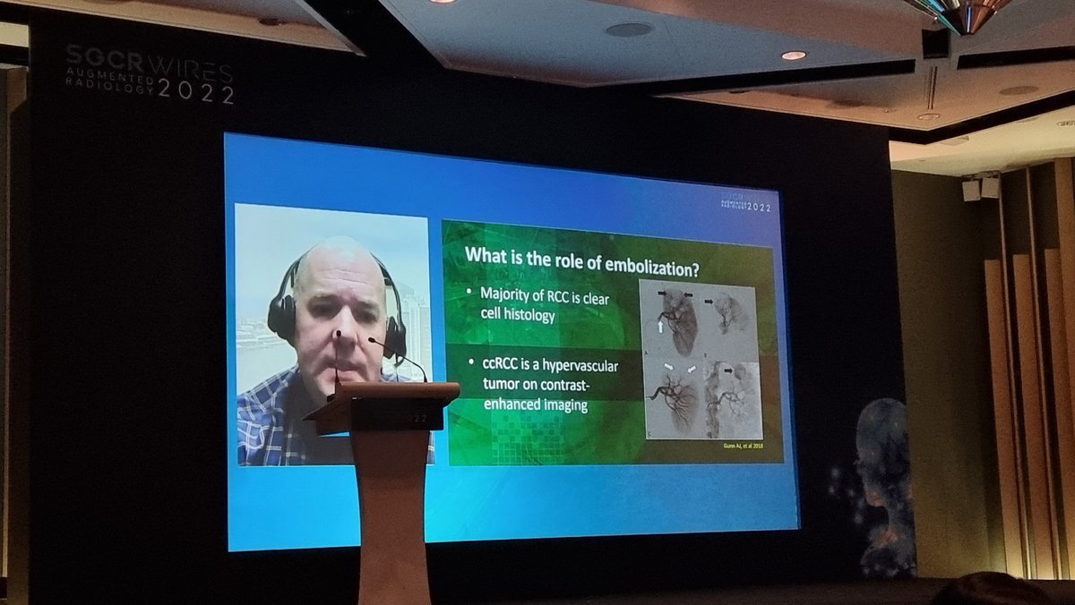 Amazing talk Dr Gunn on pre-ablation embolisation of RCC at SGCR-WIRES 2022. 

#sgcrwires2022 #rcc #embolisation #singapore