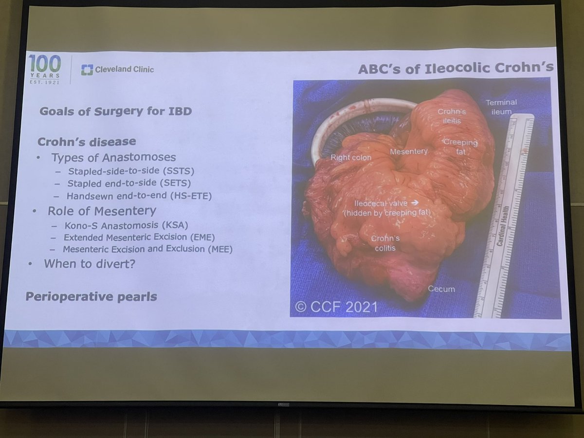 Excelente presentacion de <a href="/HolubarStefan/">Stefan Holubar MD MS</a> #colorectalsurgery #SoMe4Surgery #ascolcoloprocteologia <a href="/juanreyesmd/">JUAN CARLOS REYES</a>