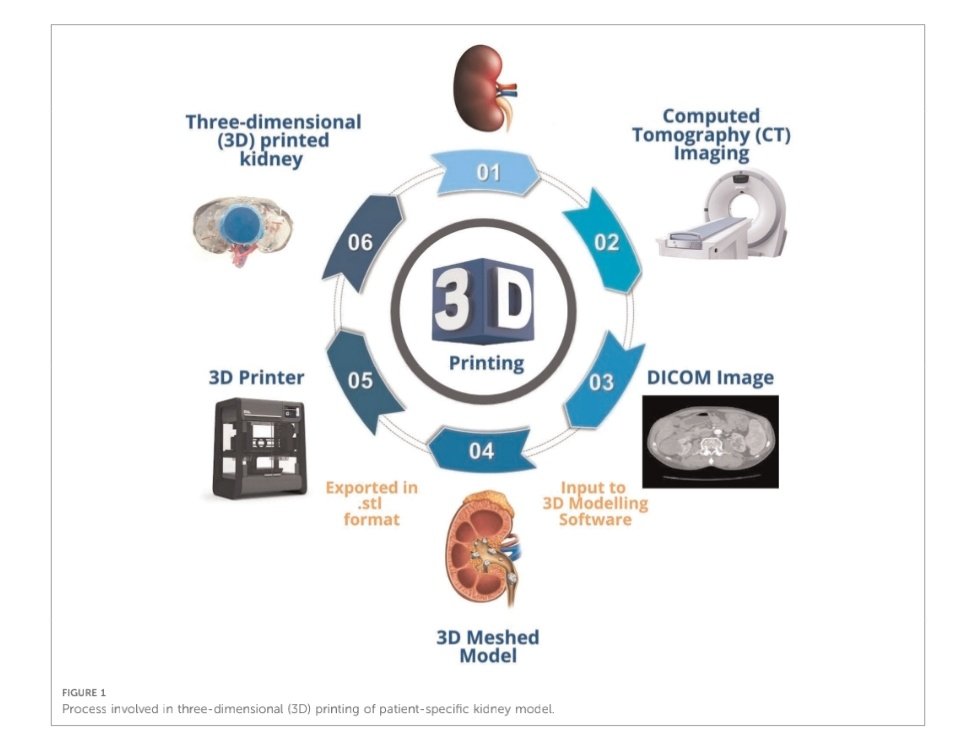 Something interesting about 3D Printing Role of (3D) printing in endourology: An update from EAU young academic urologists (YAU) urolithiasis and endourology working group doi.org/10.3389/fsurg.… #3Dprinting #3DModel @Ornate_Brute @UroZedman @endouro @PiotrChlosta @drshetty