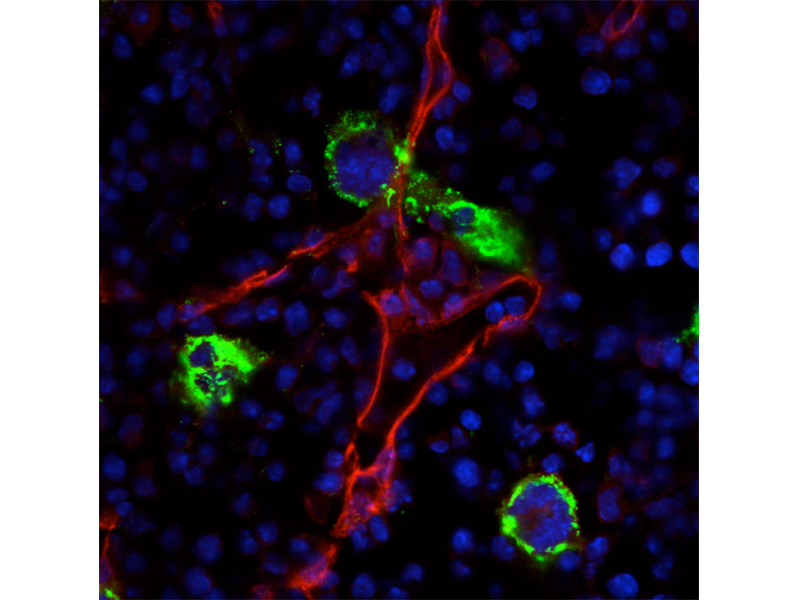 Carsten Deppermann (@plateletcarsten) on Twitter photo Abstract deadline for the <a href="/GordonConf/">Gordon Research Conferences</a> on MK and Plts 2023 Seminar in 🇮🇹 is approaching fast: Sept 5. So if you or your fellow PhD students/PostDoc would like to give a talk, submit your abstract TODAY grc.org/cell-biology-o… #platelets <a href="/JTHjournal/">JTH</a> <a href="/isth/">ISTH</a> <a href="/plateletsociety/">The Platelet Society</a> Abstract deadline for the <a href="/GordonConf/">Gordon Research Conferences</a> on MK and Plts 2023 Seminar in 🇮🇹 is approaching fast: Sept 5. So if you or your fellow PhD students/PostDoc would like to give a talk, submit your abstract TODAY grc.org/cell-biology-o… #platelets <a href="/JTHjournal/">JTH</a> <a href="/isth/">ISTH</a> <a href="/plateletsociety/">The Platelet Society</a>