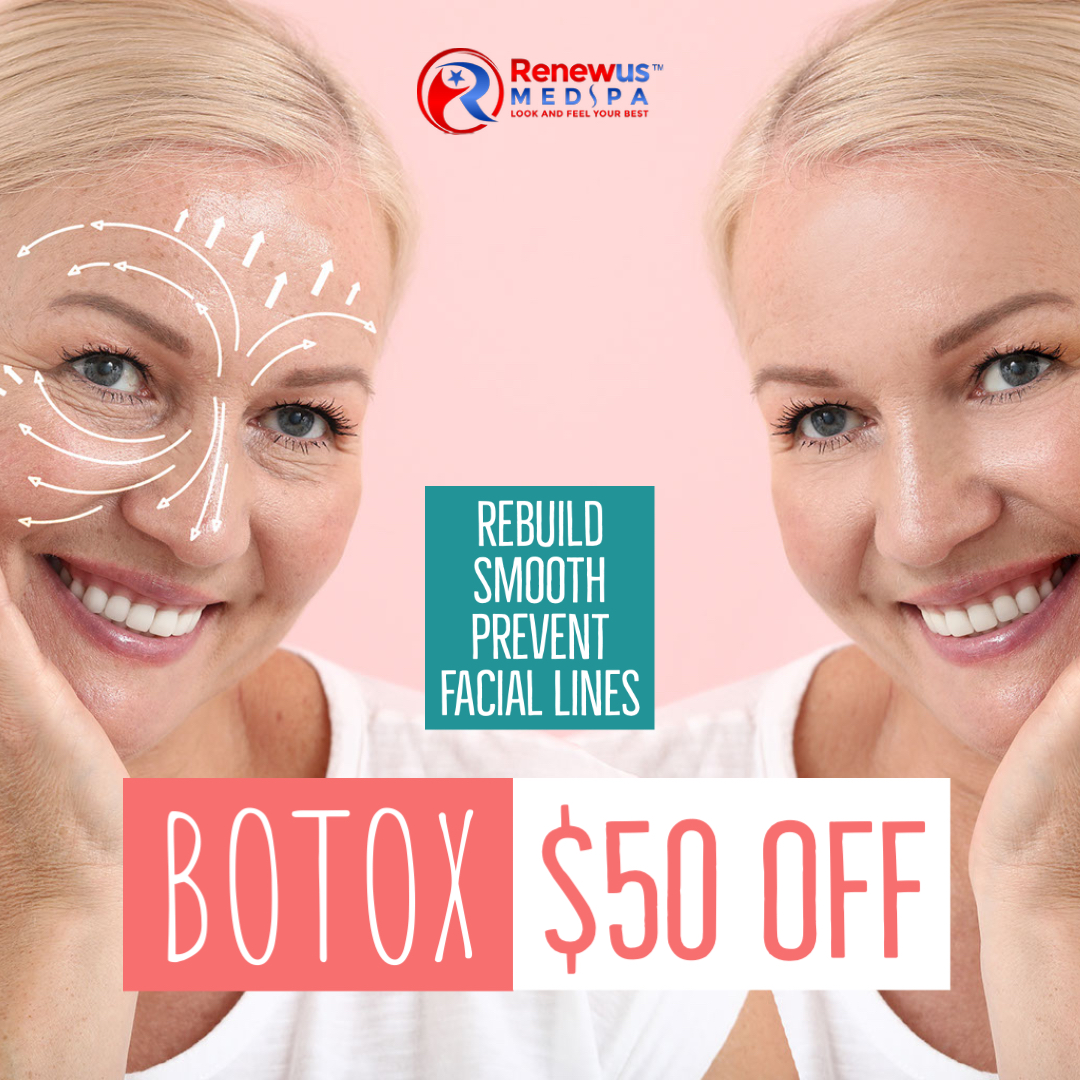 😘Rebuild, Smooooth & Prevent Facial Lines!

$50 off Botox

888-210-3054
renewusmedspa.com

#botoxsale #botox #smoothfacelines #rebuild #medspaoffer #medspadeal #facelines #wrinkle #wrinklefreeface #smoothlines #cherryhillmedspa #renewuswc #renewusmedspa