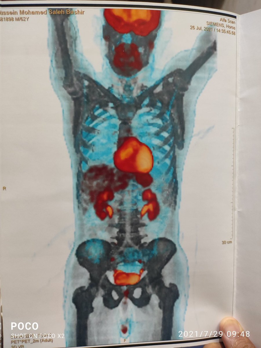 fudahospital.com 广州复大肿瘤医院_国家临床重点肿瘤专科_JCI认证医院_暨南大学附属肿瘤医院