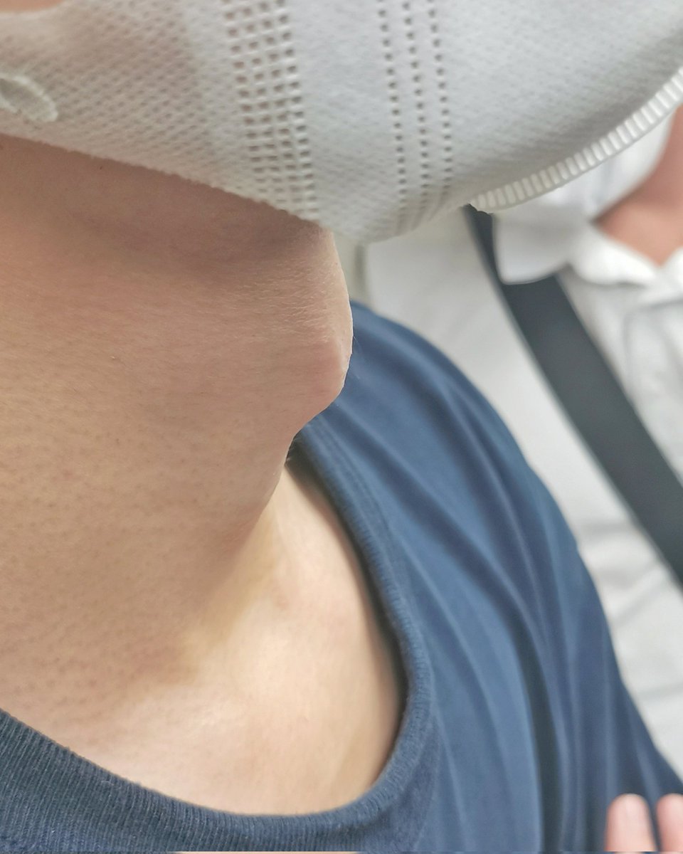 SCNU0729's tweet photo. On the subway to Jiahe Wanggang I found this protruding adam's apple. https://t.co/582zRVtY0o