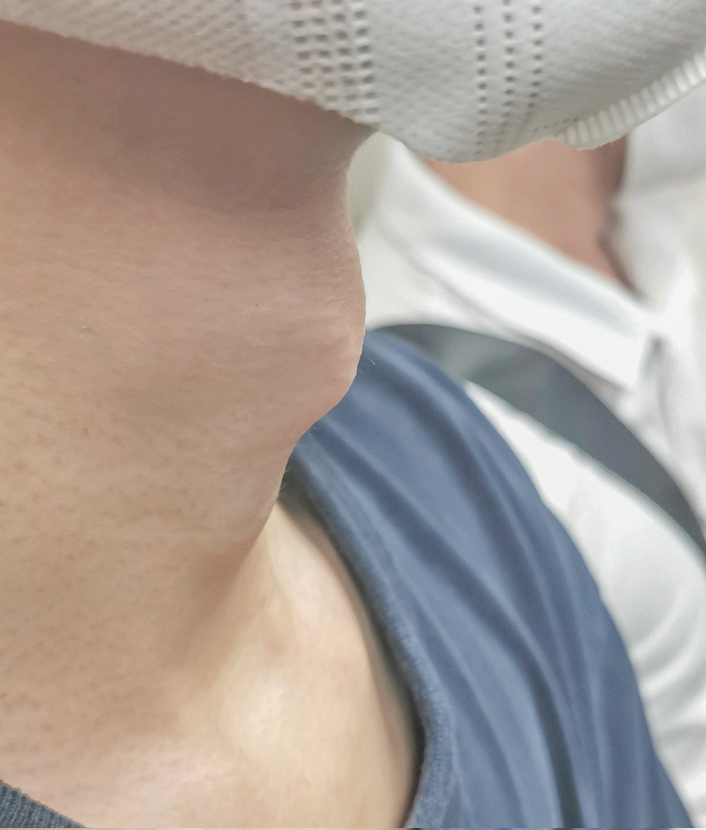 SCNU0729's tweet photo. On the subway to Jiahe Wanggang I found this protruding adam's apple. https://t.co/582zRVtY0o