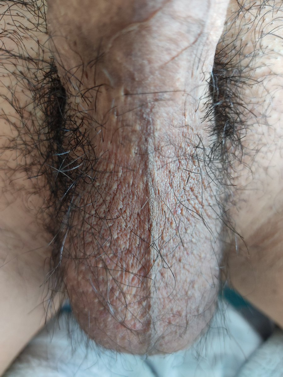 星期一是藍色的？
Monday is blue?

#gayexhibitionist