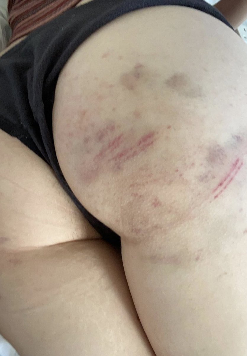 misadventurevee's tweet photo. A very enjoyable Sunday #spanked #spank #sexwithastranger #openrelationship #nsfw #nsfwtwt https://t.co/5RPxl8BvPv