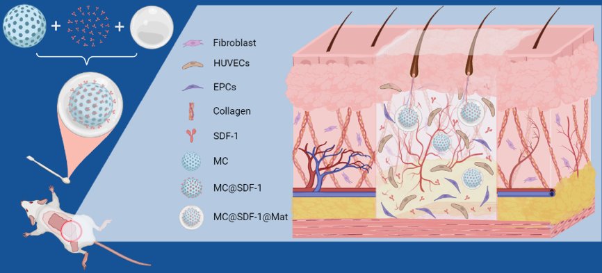 Kenny Man (@drkennyman) on Twitter photo Delighted to share our latest collaborative paper now out in <a href="/ACSBiomaterials/">ACS Biomat Sci & Eng</a>. Here we developed an SDF-1 functionalized hydrogel microcarrier to promote skin flap repair. Great collaboration with Dr Jingying Zhang! #Biomaterials #Bioengineering bit.ly/3BnN6Fi Delighted to share our latest collaborative paper now out in <a href="/ACSBiomaterials/">ACS Biomat Sci & Eng</a>. Here we developed an SDF-1 functionalized hydrogel microcarrier to promote skin flap repair. Great collaboration with Dr Jingying Zhang! #Biomaterials #Bioengineering bit.ly/3BnN6Fi