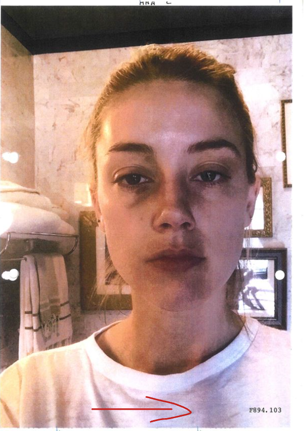 This picture is so heavily edited that even Amber Heard's shirt has a bruise... 
#AmberHeardIsAMonster #AmberHeardIsALiar