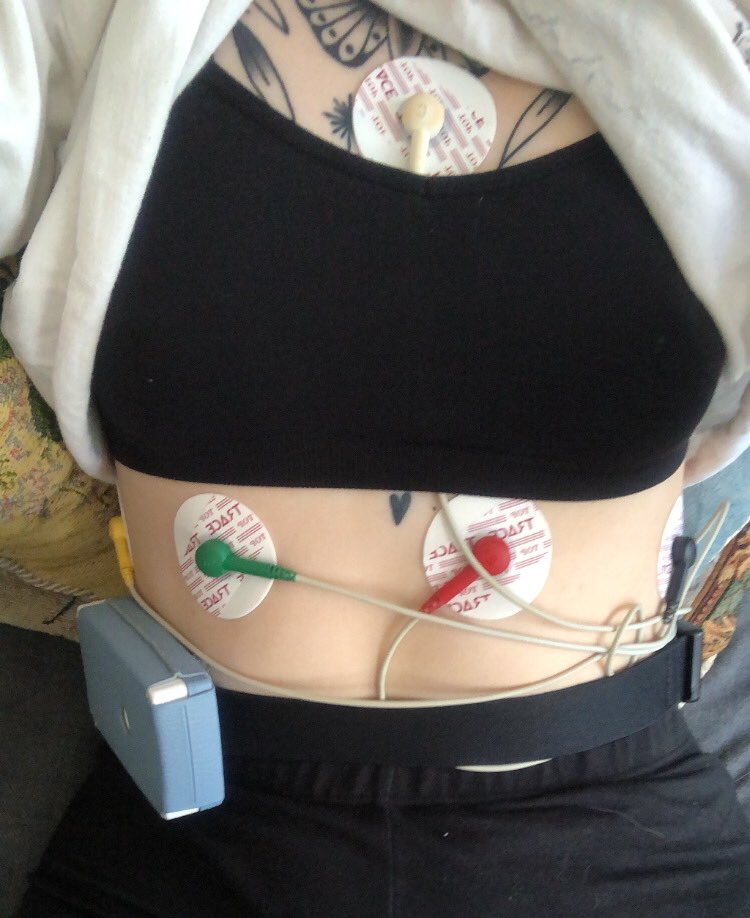 gumbleedz's tweet photo. update i got a heart monitor lmao https://t.co/KMywhXJpyy