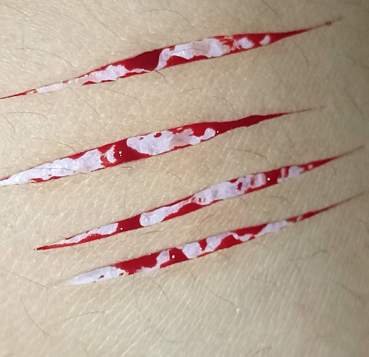ZarithAlberich's tweet photo. //tw// shtwt , selfharm , self harm , barcodetwt , catscratchtwt , ouchietwt , styrotwt
.
.
.
I really love these. 🤩 https://t.co/GnAo3l8UMv