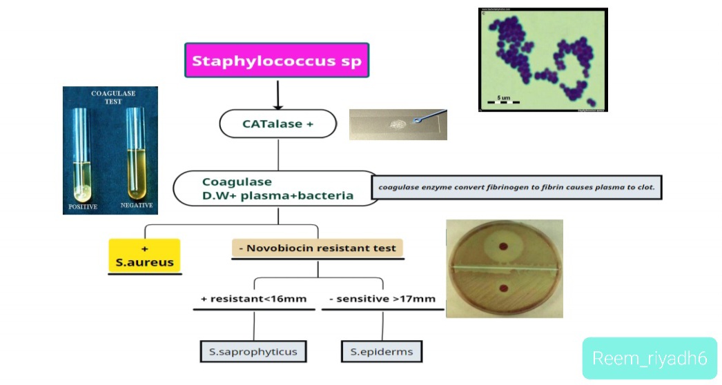 Reem_riyadh6's tweet photo. أسهل طريقة لإستذكار بكتيريا الستافيلوكوكاس وانواعها والbiochemical tests 👍
من كورس الmind maps 

#Mind_maps
#bacteriology 
#Staphylococcus https://t.co/mFh6kiUGWS