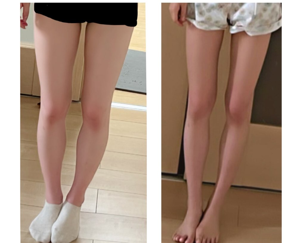 ゆちゃん 脚やせ研究51 37kg Yuchaos M Twitter