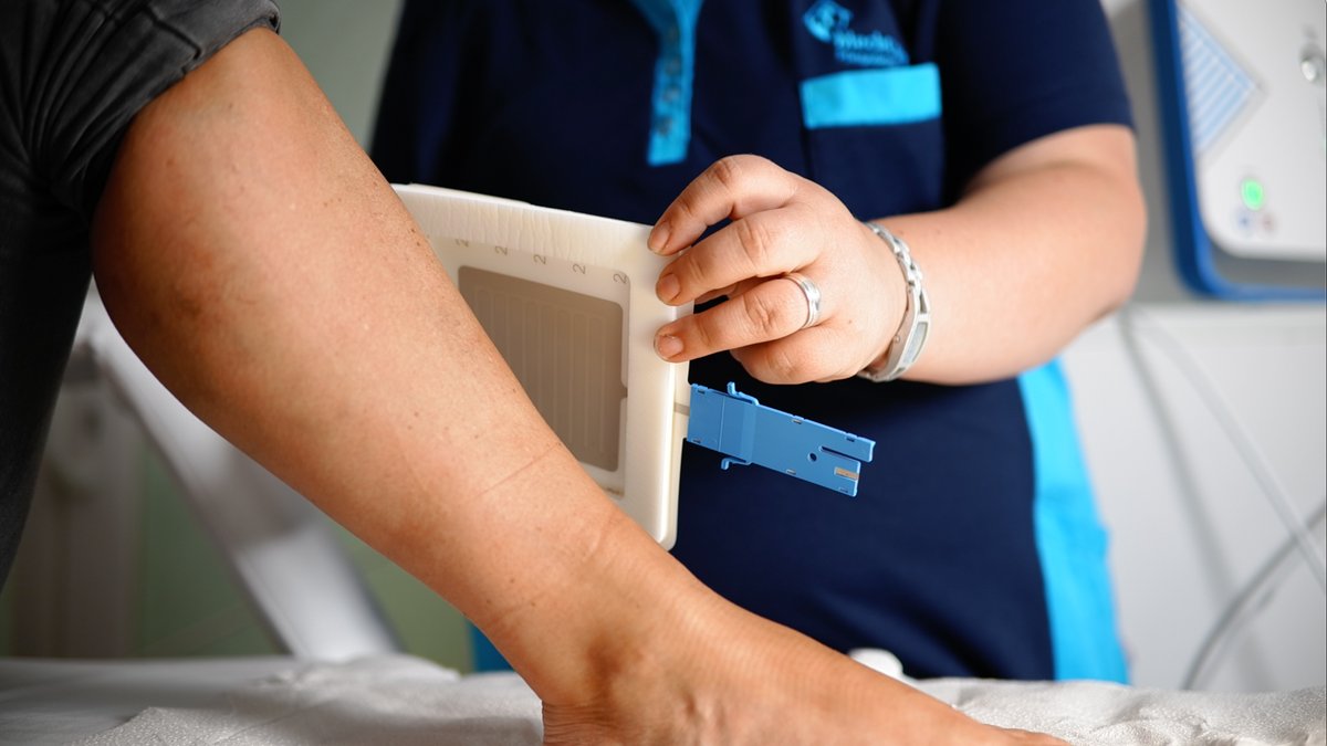 coldplasmatech's tweet image. Das ist Antje, sie behandelt Patienten/innen mit #chronischenWunden in einem unserer bundesweiten CPT Plasma.Kompetenz.Zentren, bei MeckCura Pflegedienst GmbH in Güstrow.
Die Behandlung ist: schnell (nur 2 Minuten), effektiv, tiefenunabhängig tötet Bakterien u. Keime, schmerzfrei