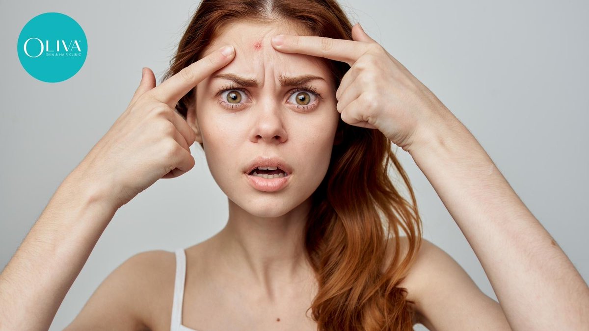 olivaclinic's tweet image. Are you suffering from painful pus-filled #pimples of late? 
A #pustule is a small pus-filled bump with a whitish-yellow appearance and a red ring around it. Click on the below link to learn more about its causes, symptoms, treatments, and prevention.

bit.ly/3OU3mky