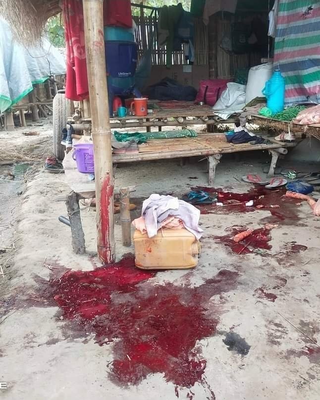 KarenniHR's tweet photo. A 13 year old girl was kill and 4 Karenni IDPs were injured by SAC motor shelled in Karenni State, Deemaw Soe Township, Saung Dular village track at 5:00pm, 31 July 2022. At least 10 times of IDP camps targeted motor shell by SAC in July 2022. https://t.co/q9FJEGXQpt