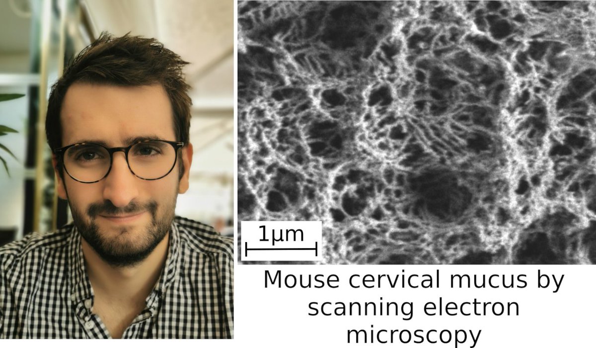 Infinite (U1286 Inserm | Univ. Lille | CHU Lille) (@lilleinfinite) on Twitter photo #SFBBM #article-of-the-month (vu.fr/Kfxu) 🏆 to Guillaume Lacroix 👏 for his study in iScience on 🐭 #preterm #birth, #mucus and #mucins. So proud.
@medecine_Ulille <a href="/univ_lille/">Université de Lille</a> <a href="/Inserm/">Inserm</a> <a href="/CHU_Lille/">CHU de Lille</a> #SFBBM #article-of-the-month (vu.fr/Kfxu) 🏆 to Guillaume Lacroix 👏 for his study in iScience on 🐭 #preterm #birth, #mucus and #mucins. So proud.
@medecine_Ulille <a href="/univ_lille/">Université de Lille</a> <a href="/Inserm/">Inserm</a> <a href="/CHU_Lille/">CHU de Lille</a>
