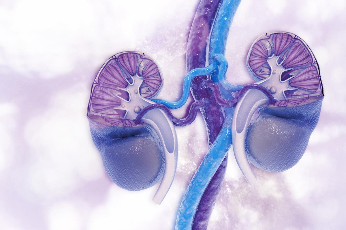 Mayo Clinic Proceedings on X: This study provides for the first time data  guiding antibiotic management of renal cyst infection in patients with  autosomal dominant polycystic kidney disease. t.coLboTPRPiFR  t.coDnGEYoeDGQ  X