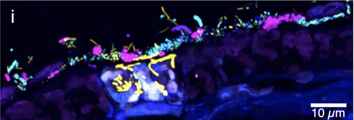 MBLScience's tweet photo. #MicroscopyMonday🔬| Kelp forests can tower up to 150 feet high, but like many living things, kelp survival depends on microorganisms associated with its surface. This image of kelp blade shows microbial biofilm on both sides of the blade.

Credit: Ramírez-Puebla et al.(2022) https://t.co/UmCPtLktNH