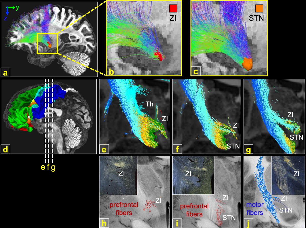 Anastasia Yendiki tweet media
