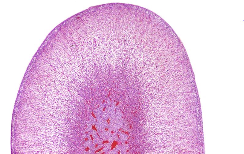 Histopatolomon's tweet photo. @nnuronat @pembeoltulu @elif_smll Great Nazire a story very well told💜
You forgot to say that you did the whole process, like making the block, cutting and staining. By the way the cuts are perfect
It vaguely reminds me of an adrenal gland #foodpath #foodiepath #FBpath #pathologist @yro854 #Ilooklikeapathologist https://t.co/itKh5QgYbQ