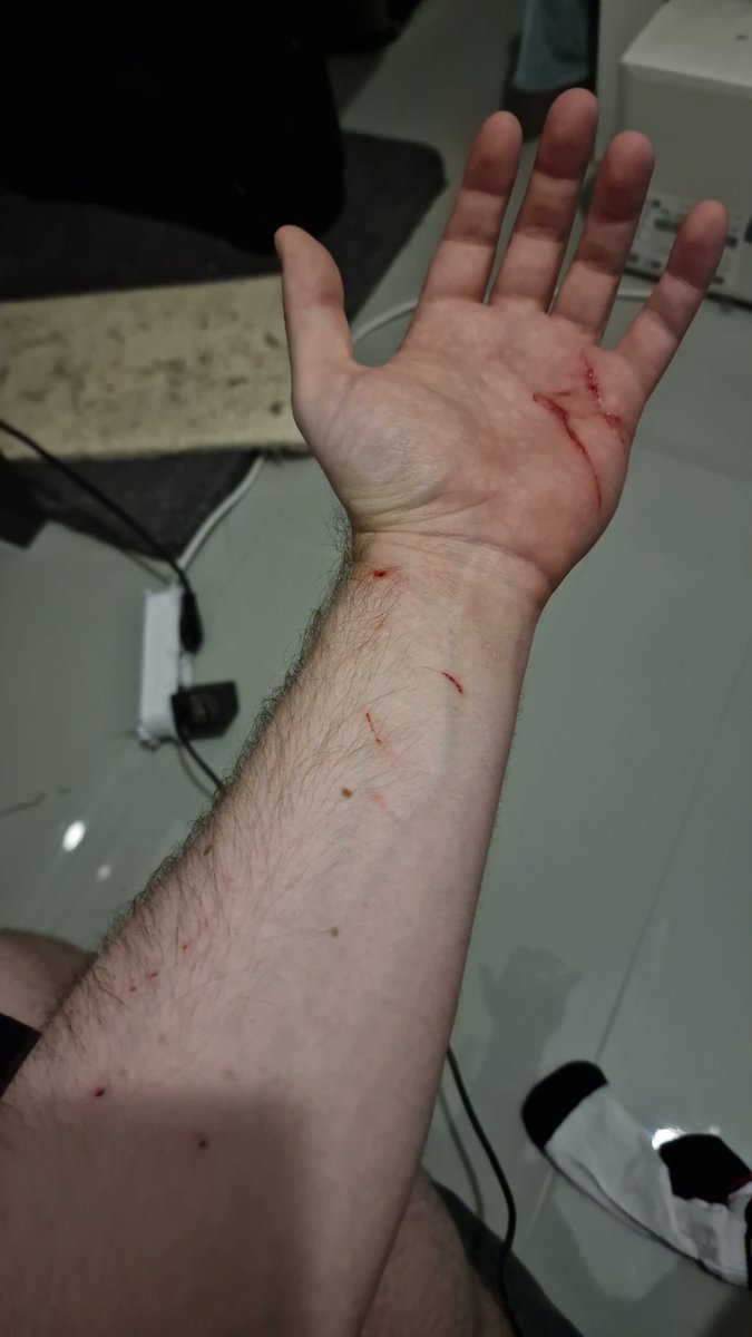 ReforgedEnTe's tweet photo. I got injured sadly, that's why I cannot play this weeks match @ESLGermany vs xlord. Unfortunately freaks4u do not believe this and even consider pictures can be fake, so I will get a deflose. See you next payday for my interviews! https://t.co/nQieRelkbz